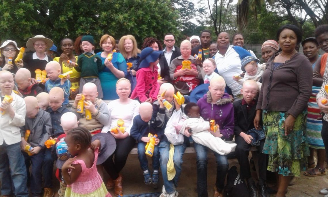 Children with albinism receive sunscreen lotions