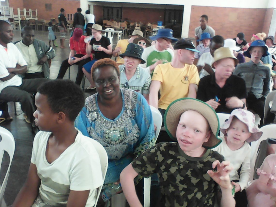 Support for people with albinism hailed