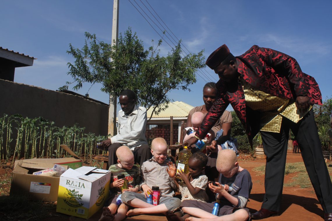 Sekuru Banda donates R11 million worth of goods to people with albinism