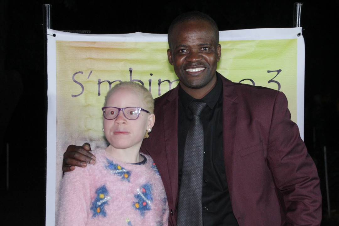 MultiChoice Zimbabwe Supports Film On Albinism S’mbimbino 3