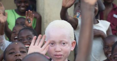 People with Albinism strengthen their campaign for protection