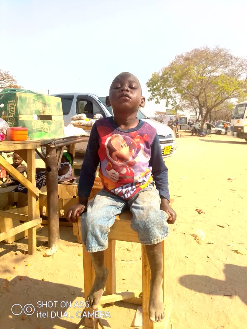 5-year-old Lasinaji Tinotenda Karedza in need of medical assistance